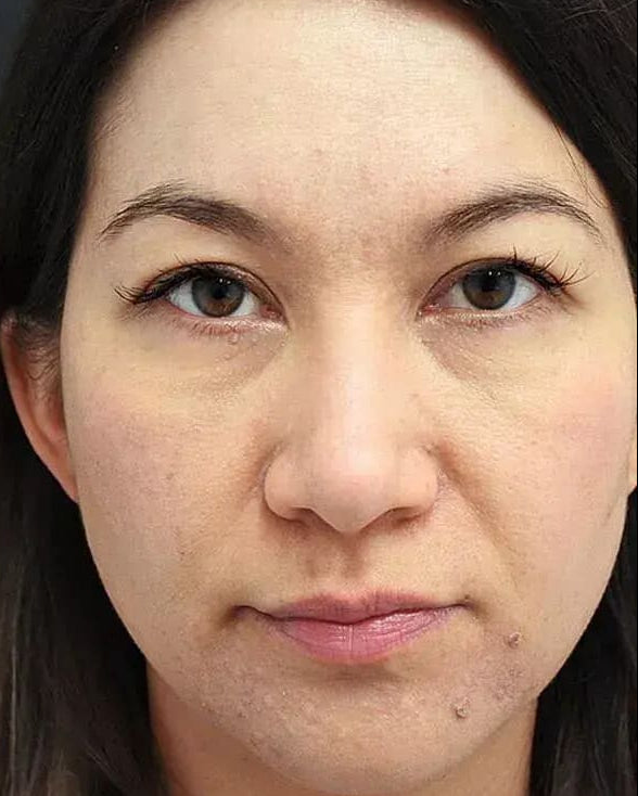 Close-up of a person with dark hair and brown eyes.