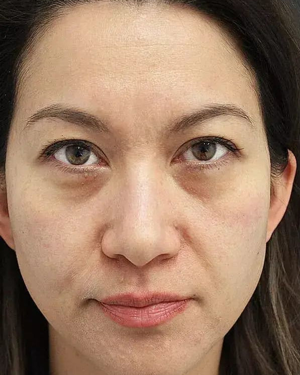 Close-up of a woman's face with a neutral expression